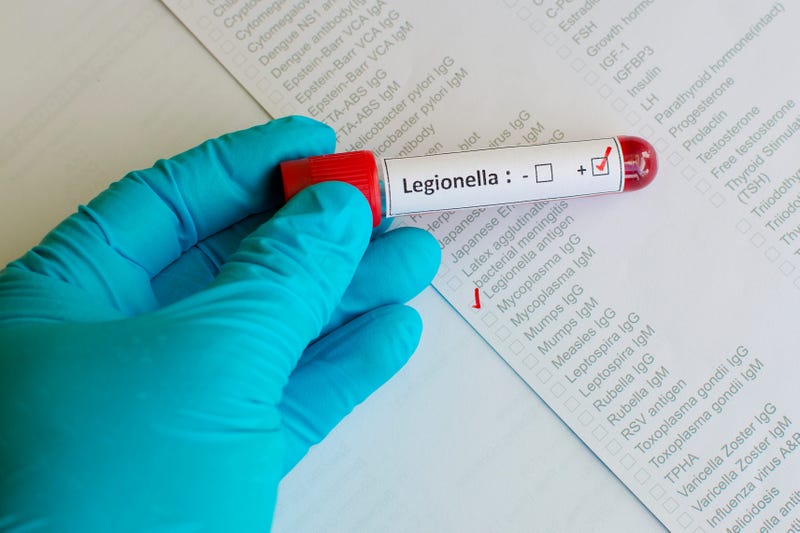 Legionnaires’ Disease