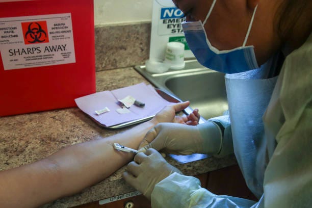 Monkeypox, Georgia, Vaccine