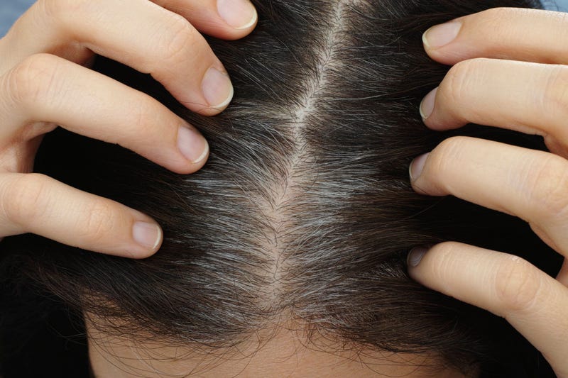 Gray Roots