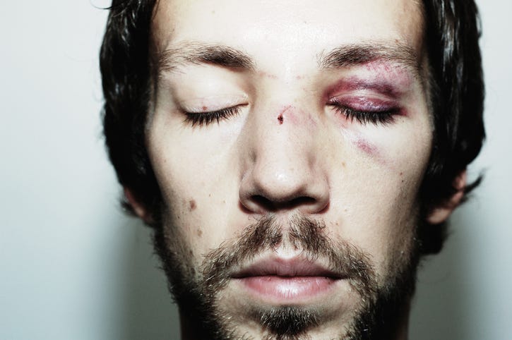 golpeado