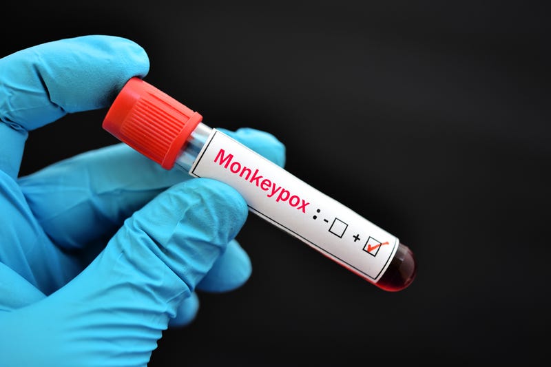 A vial of blood that tested positive for monkeypox