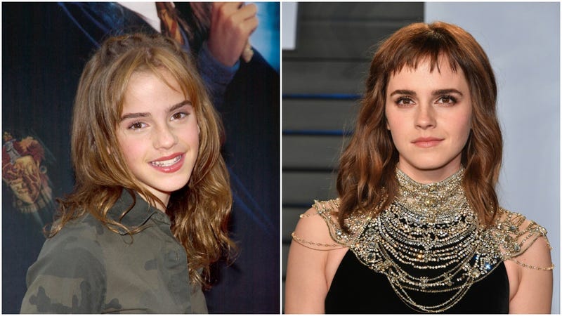 emma watson then and now