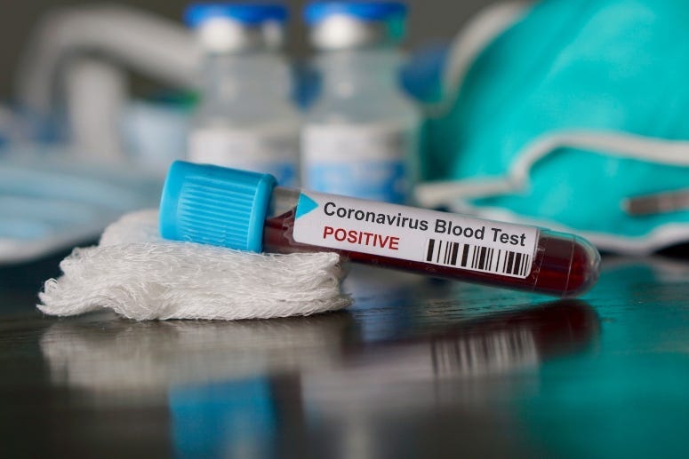 Positive Coronavirus
