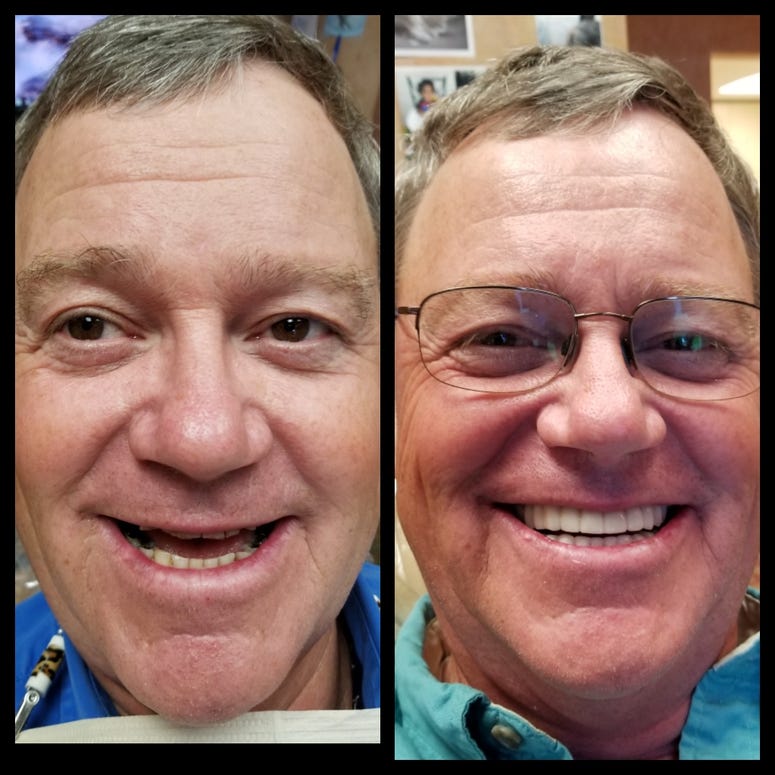 BEFORE AND AFTER