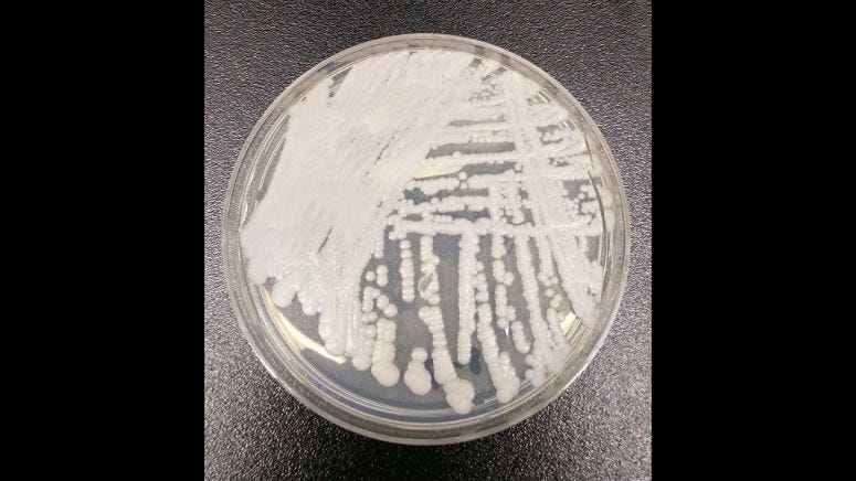According to the CDC, C. auris can travel through health care facilities by lingering on surfaces and medical equipment, or it can spread directly from one person to another.