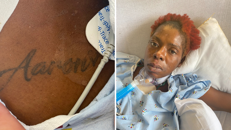 Police trying to identify woman placed in 3-week coma after being hit by car in Lawncrest