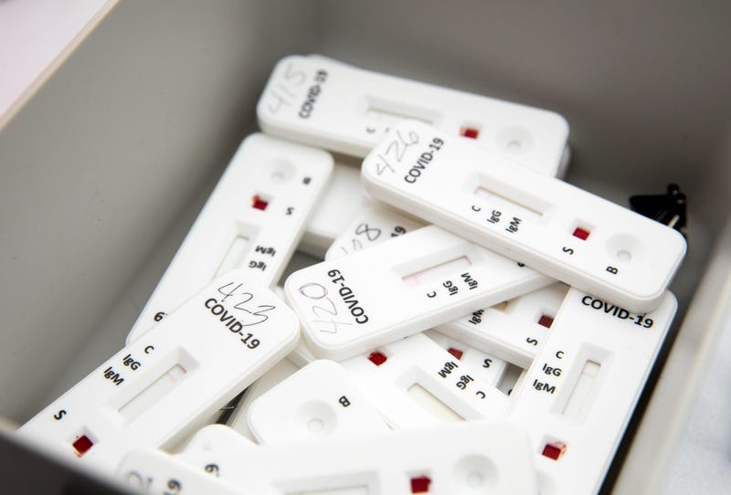 Antibody tests