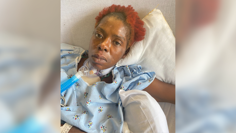 Police trying to identify woman placed in 3-week coma after being hit by car in Lawncrest