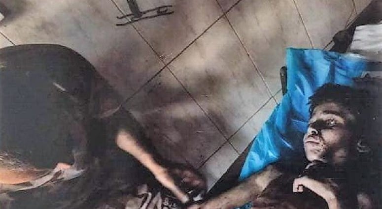 A small boy in Mosul. He came severely dehydrated and malnourished.