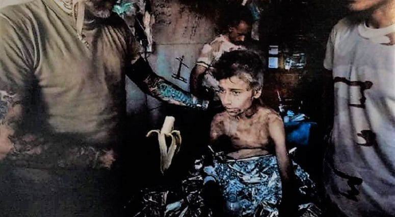 A small boy in Mosul. He came severely dehydrated and malnourished.