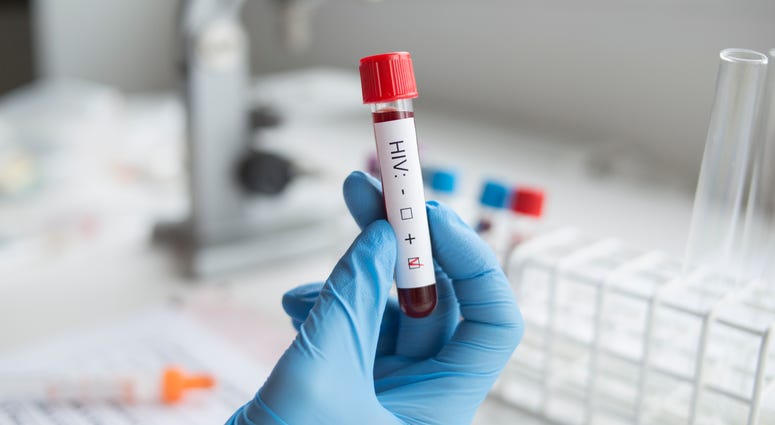 HIV Test