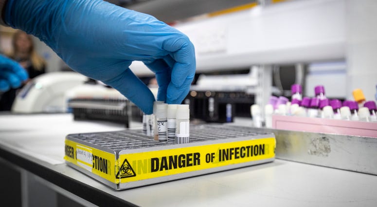 Clinical support technician Douglas Condie extracts viruses from swab samples so that the genetic structure of a virus can be analysed and identified in the coronavirus testing laboratory at Glasgow Royal Infirmary, on February 19, 2020 in Scotland