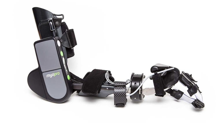 This device, which senses the wearer's neurological signals, allows arm use to some who have lost it.