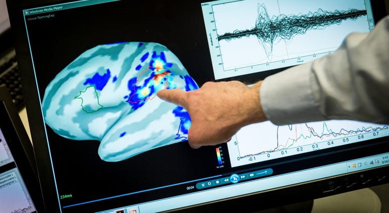 Magnetoencephalography (MEG) Laboratory scientist, Mihai Popescu points out areas of magnetic activity in a brain on a display at the National Intrepid Center of Excellence (NICoE) at Walter Reed National Military Medical Center in Bethesda, Md., 2017. BrainImage