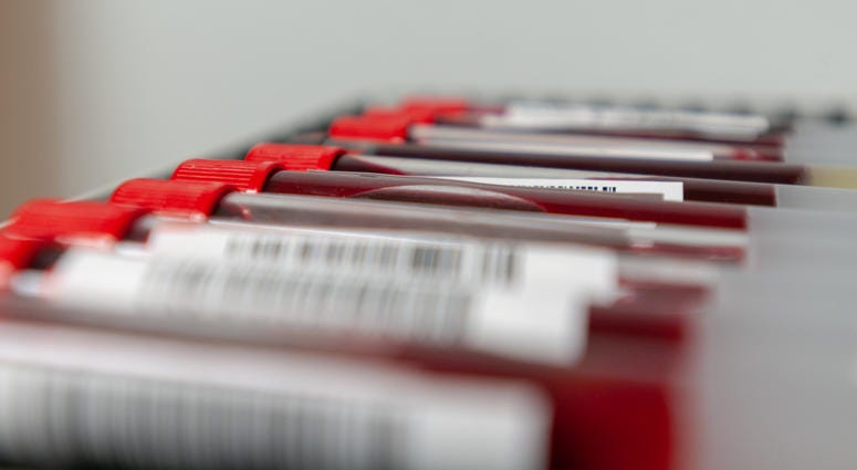 Blood Test Vials