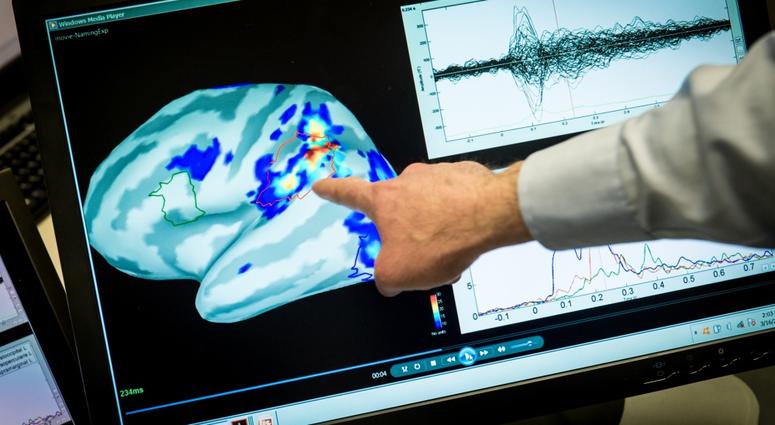 Magnetoencephalography (MEG) Laboratory scientist, Mihai Popescu points out areas of magnetic activity in a brain on a display at the National Intrepid Center of Excellence (NICoE) at Walter Reed National Military Medical Center in Bethesda, Md., 2017. BrainImage