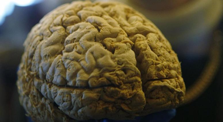A resident takes a look at a human brain specimen at a Brain Health Fair. Female brain tissue donation is almost nonexistent right now, but VA and PINK Concussions hope to change that.