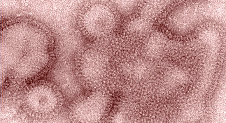 This 2011 electron microscope image provided by the Centers for Disease Control and Prevention shows H3N2 influenza virions. AP DO NOT USE