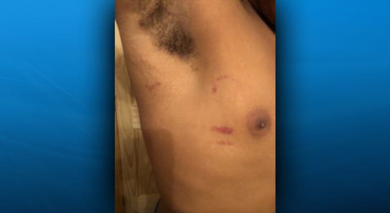 Plum football player alleges his coach attacked him after a game