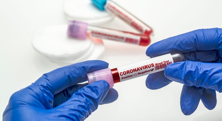 Coronavirus Test Coronavirus Test