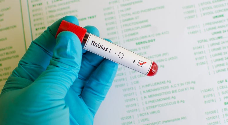 Rabies Test