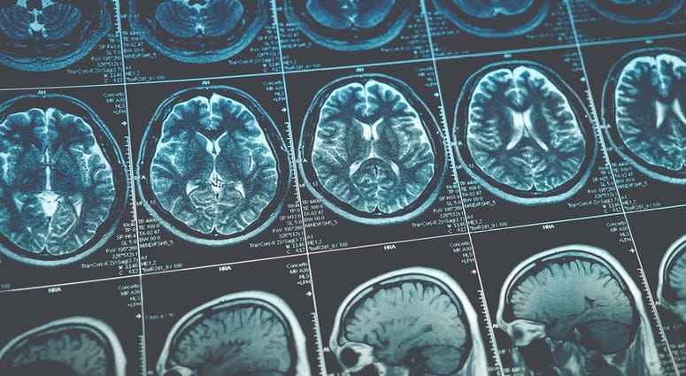 Brain Scan Brain Scan