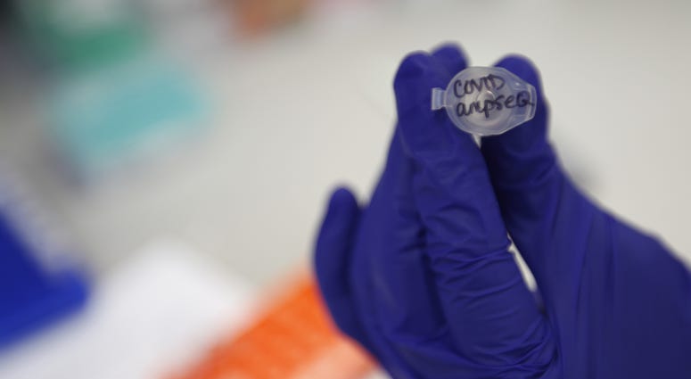 Corona Virus Lab Test