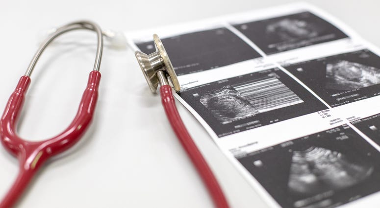 abortion
