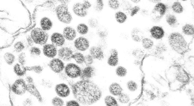 coronavirus