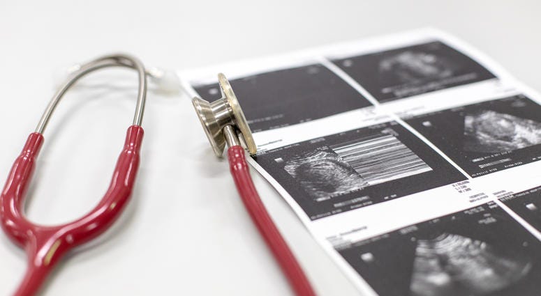 abortion