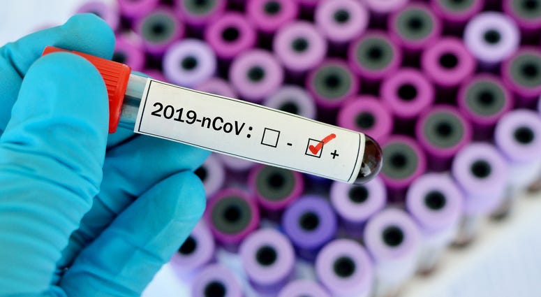 Positive coronavirus test