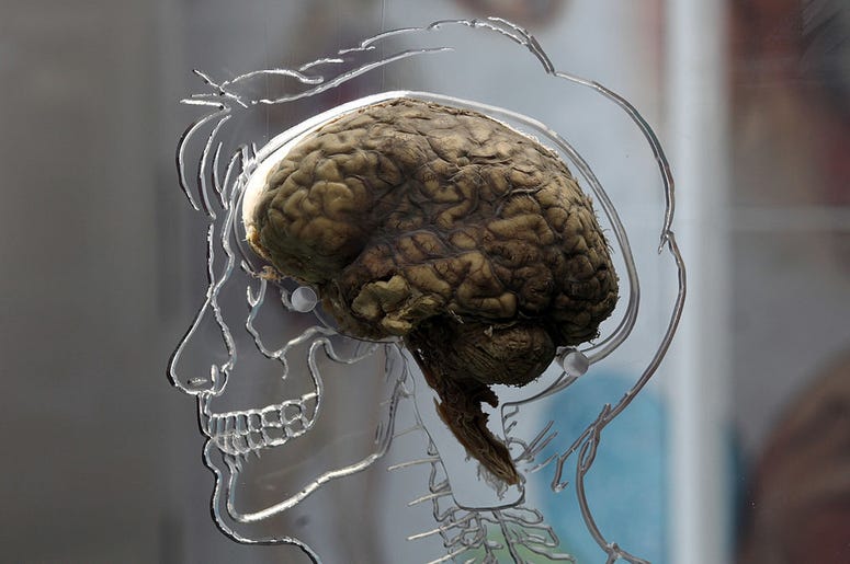 brain brain