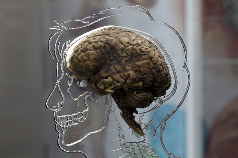 brain brain