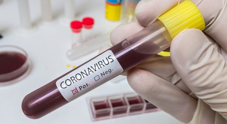 COVID-19 Positive Test
