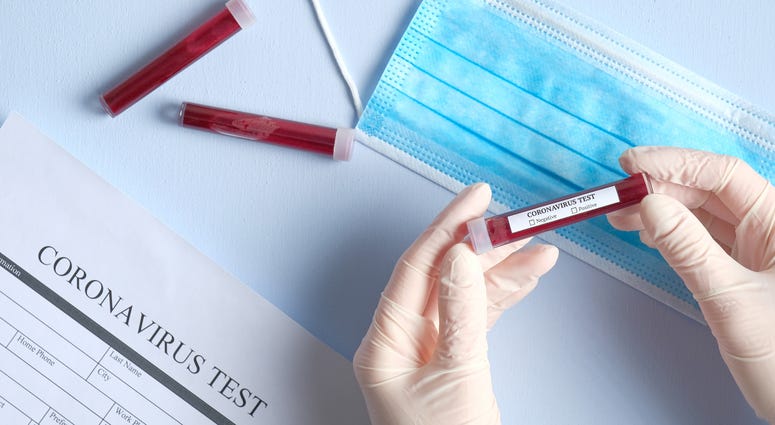 Coronavirus-Test