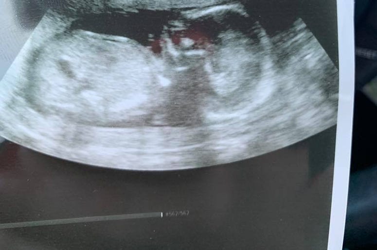 Baby Gender Reveal