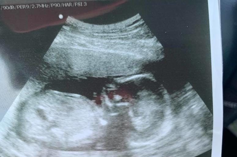 Baby Gender Reveal