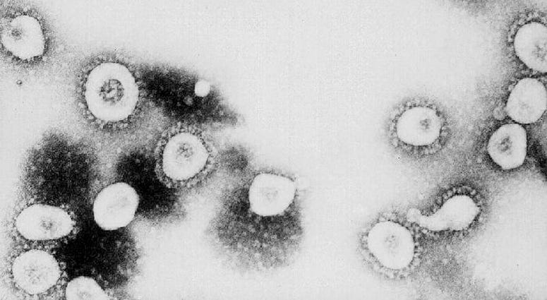 This undated handout photo from the Centers for Disease Control and Prevention (CDC) shows a microscopic view of the Coronavirus at the CDC in Atlanta, Georgia.