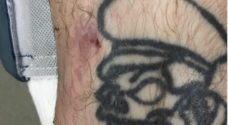 Tattoo found on right leg of man discovered on roadside July 5, 2019 in Madison County Illinois.
