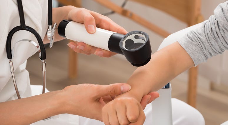 doctor, kids, pediatrician Close-up Of Doctor Examining Skin Of Child Patient With Dermatoscope
