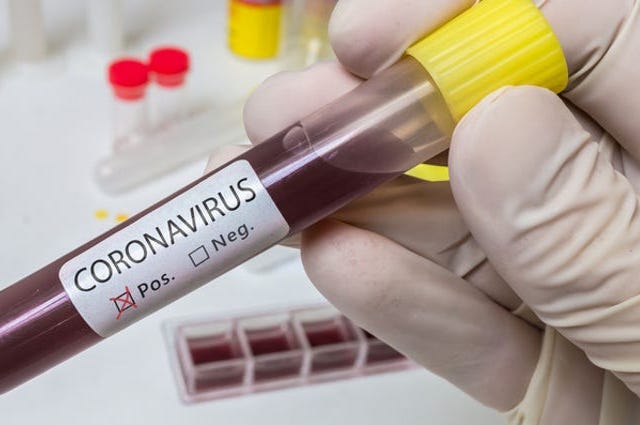 Coronavirus