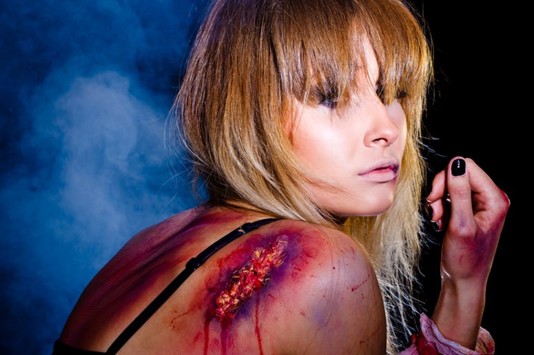 Por Dejarse Planchar El Hombro, Actriz Mexicana Sufre Quemadura De Segundo Grado Bruised and wounded woman who survived after a tough fight; studio shot