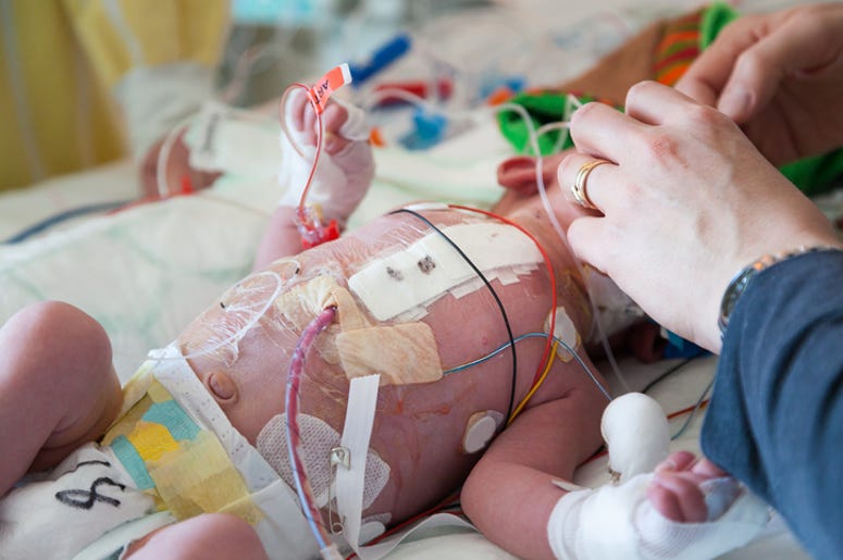 Jueza Autoriza A Hospital De Fort Worth A Desconectar A Bebé de Soporte De Vida Artificial Child intensive care, mother and son
