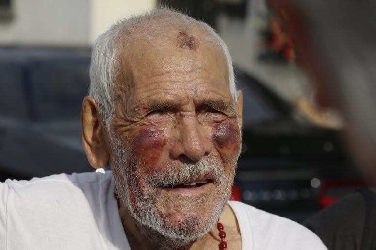 Hombre Golpeado Hombre Golpeado