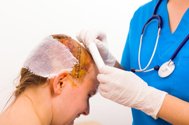 Facebook Live De Operación de Cerebro A Mujer De Dallas Que Estuvo Despierta Surgeon with protective glove bandaging smiling victim's head after skull fraction.