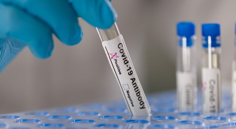 Dillons announces coronavirus rapid antibody testing at all pharmacy locations