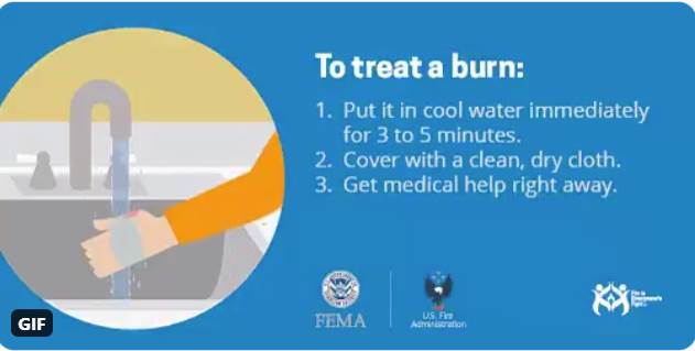 Burn treatment