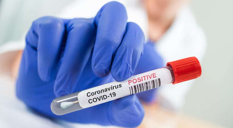 Coronavirus infected blood sample tube