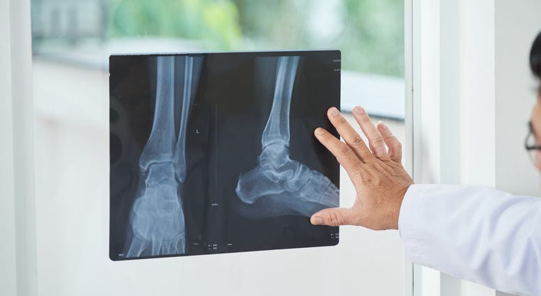 Doctor looking at X-ray picture