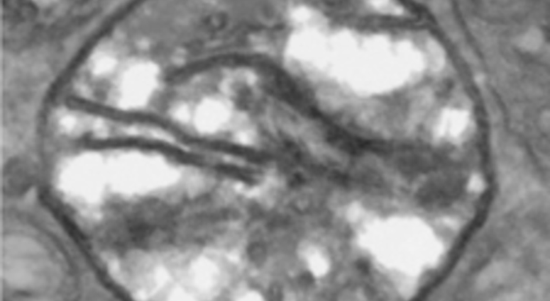 Henneguya salminicola is a multicellular organism, but it doesn't need oxygen to breathe, scientists say.